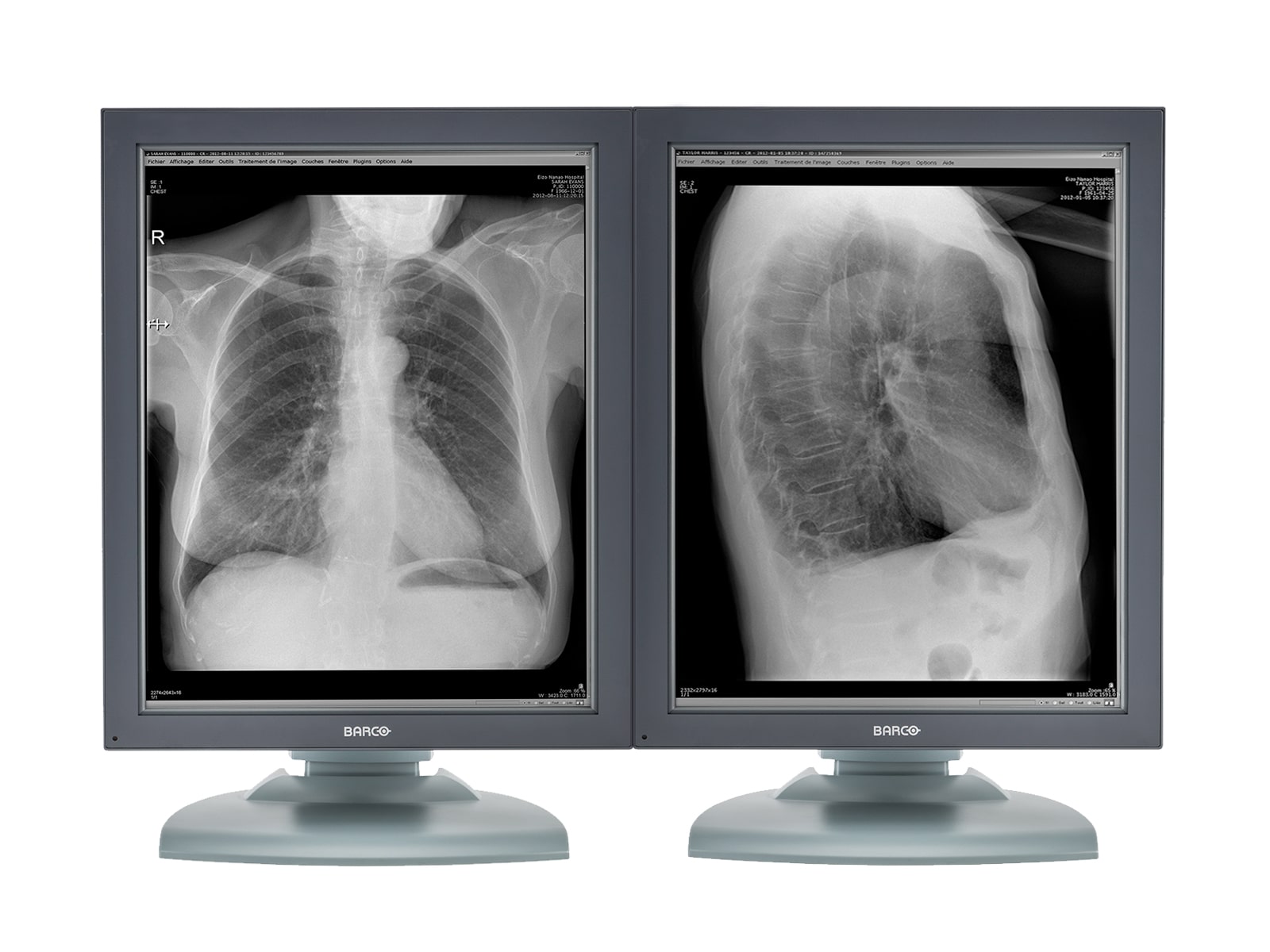 Barco Moniteur de radiologie diagnostique médicale Nio MDNG-2121 2MP 21" en niveaux de gris (K9601651) Monitors.com