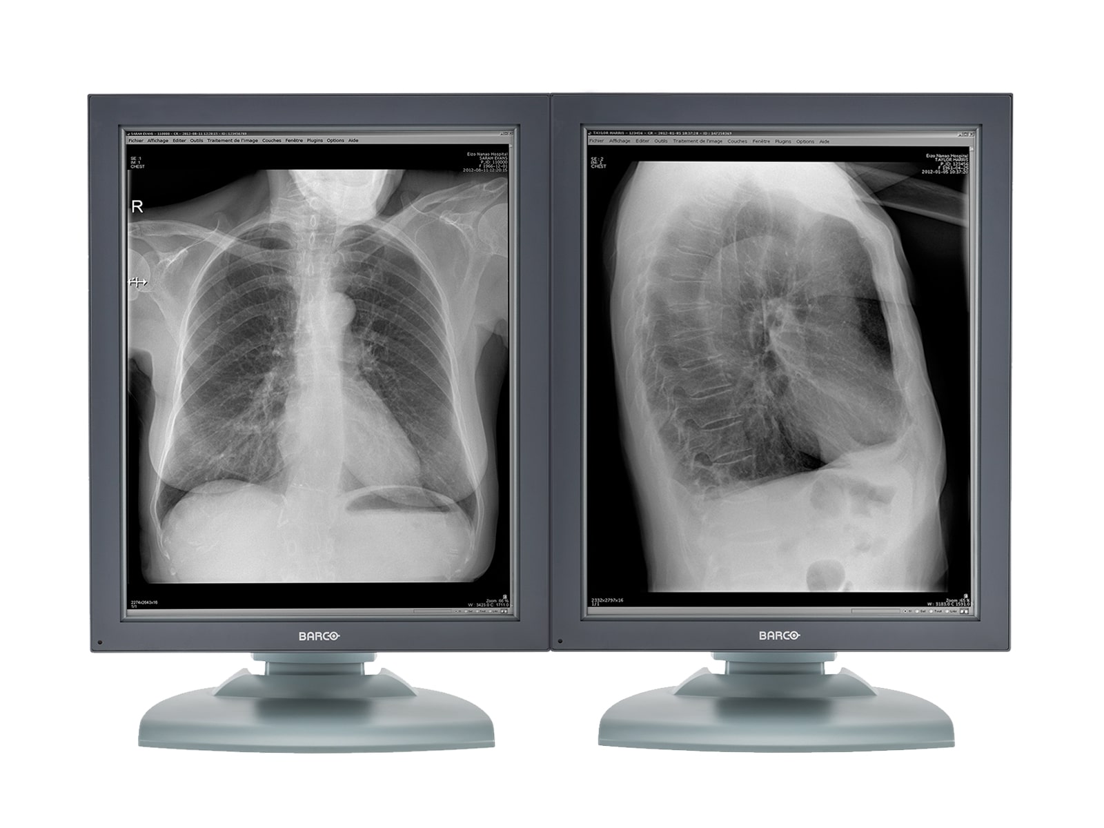 Barco Nio MDNG-2121 2MP 21" Grayscale Medical Diagnostic Radiology Monitor (K9601651) Monitors.com 