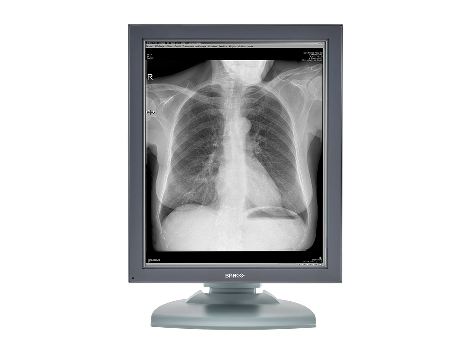 Barco Nio MDNG-2121 2MP 21" Graustufen-Monitor für medizinische Diagnostik und Radiologie (K9601651) Monitors.com