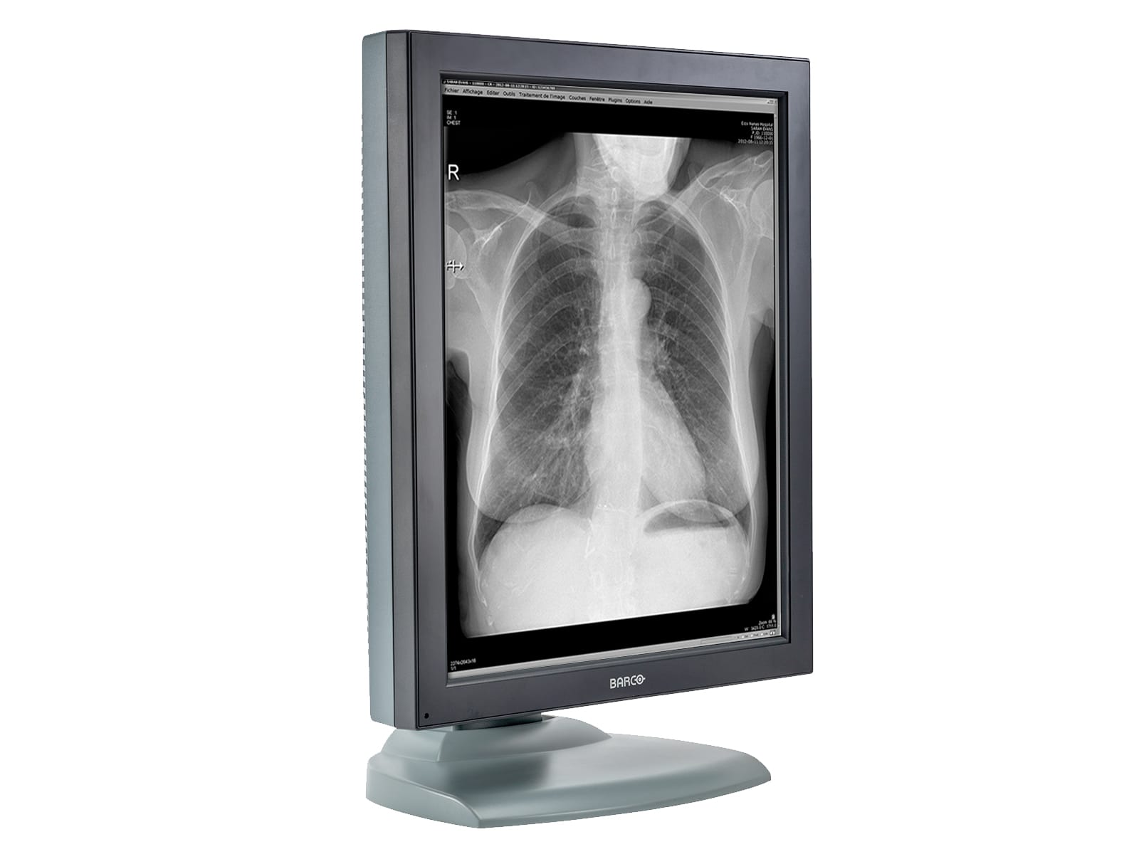 Barco Nio MDNG-2121 2MP 21" Grayscale Medical Diagnostic Radiology Monitor (K9601651) Monitors.com 