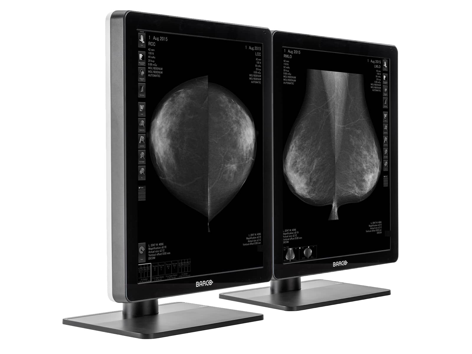 Barco Nio MDNG-5221 5MP 21" Grayscale LED 3D-DBT Μαστογραφία Απεικόνιση Μαστού Οθόνη PACS