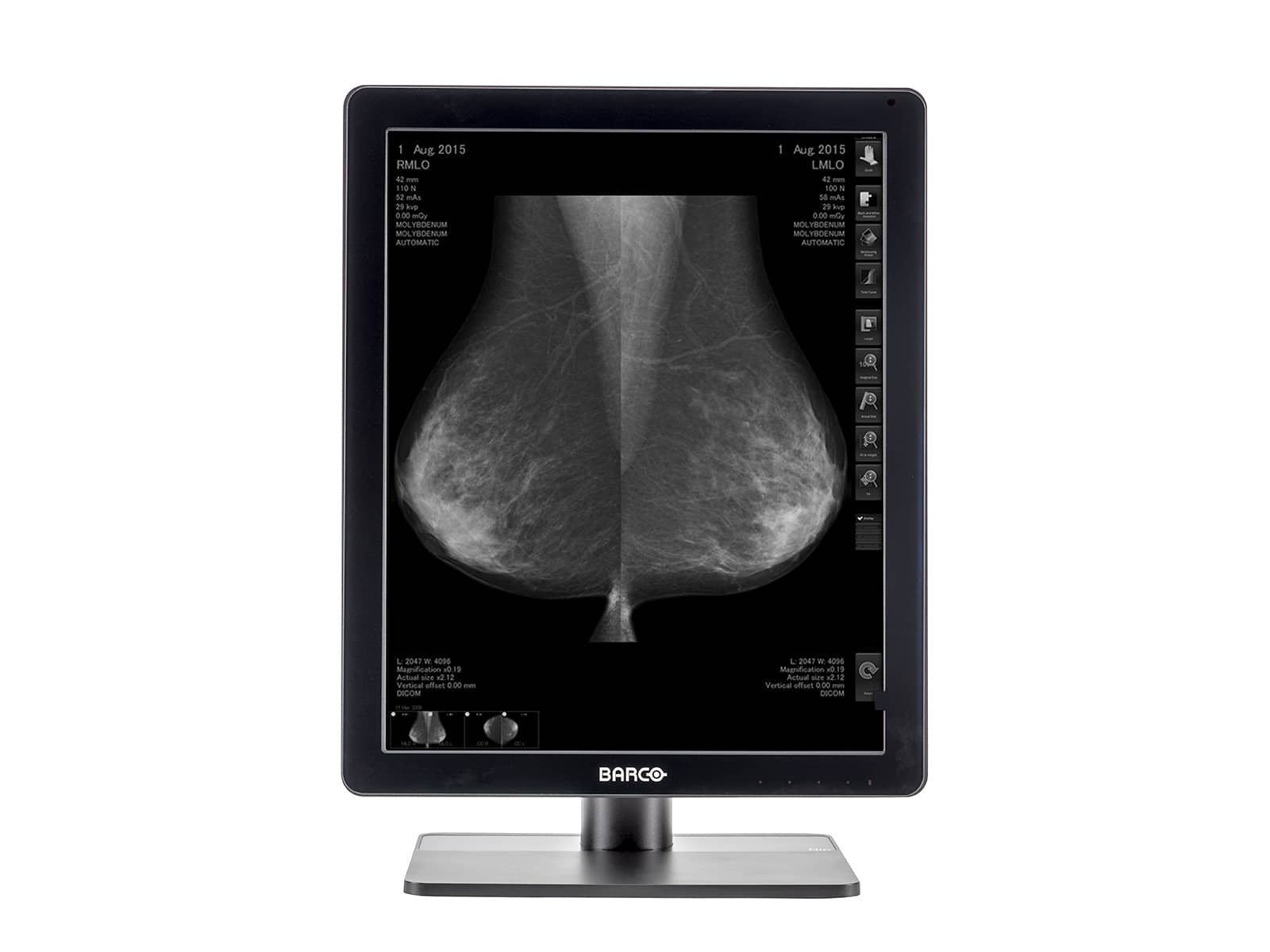 Barco Nio MDNG-5221 5MP 21" Grayscale LED 3D-DBT Mammography Breast Imaging PACS Display