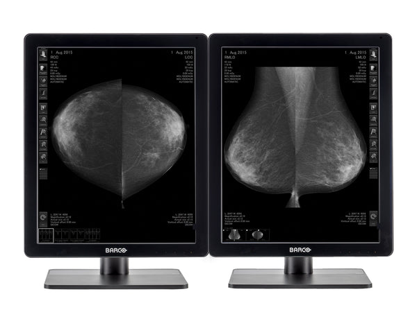 Complete Mammography Reading Station | Barco MDNG-5221 5MP Grayscale LED Monitors | HP Workstation | Dictation Mic | Worklist Monitors (QNG5221Z4R)