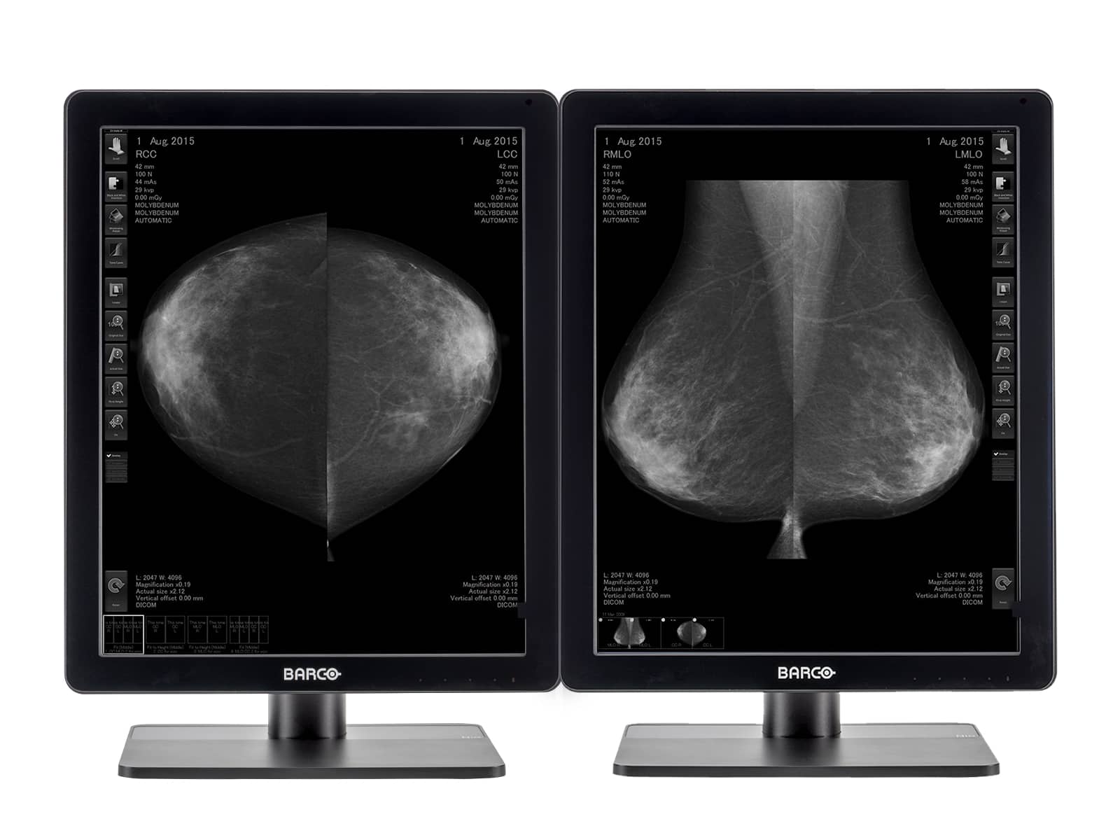 Barco Écran PACS d'imagerie mammaire Nio MDNG-5221 en niveaux de gris 3D-DBT Mammo (K9300350B) Monitors.com