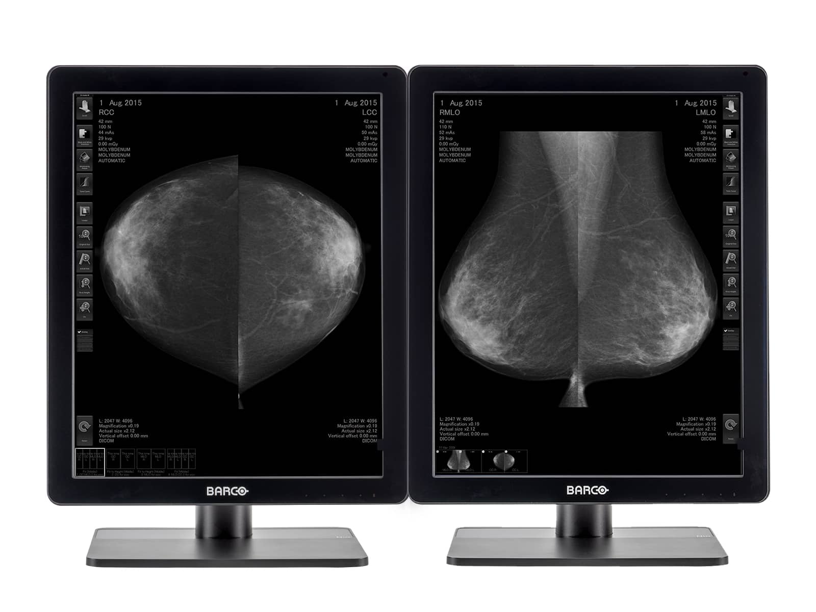 Barco Nio MDNG-5221 Pantalla PACS para imágenes mamarias 3D-DBT en escala de grises (K9300350B) Monitors.com