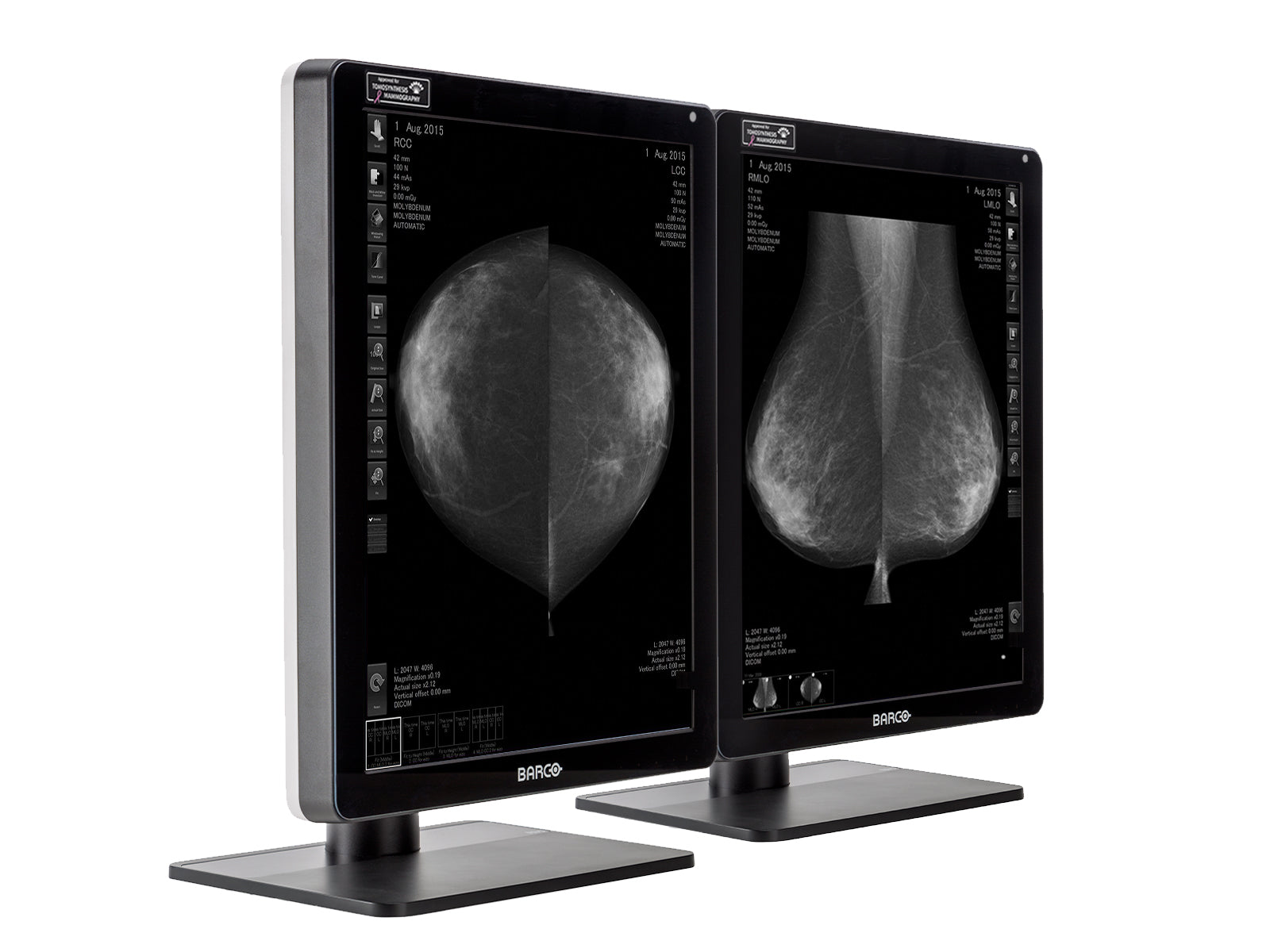 Barco Nio MDNG-6221 5MP 21" Grayscale LED Mammo 3D-DBT Breast Imaging Display