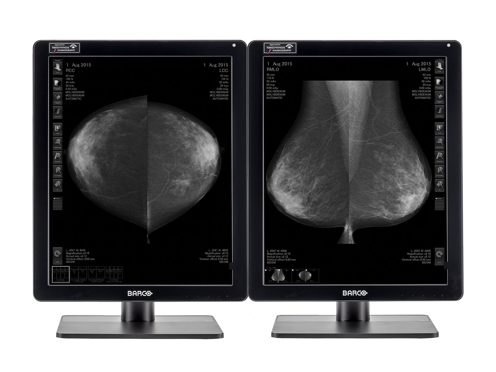 Barco Nio MDNG-6221 5MP 21" Écran d'imagerie mammaire LED Mammo 3D-DBT en niveaux de gris (K9300372B)