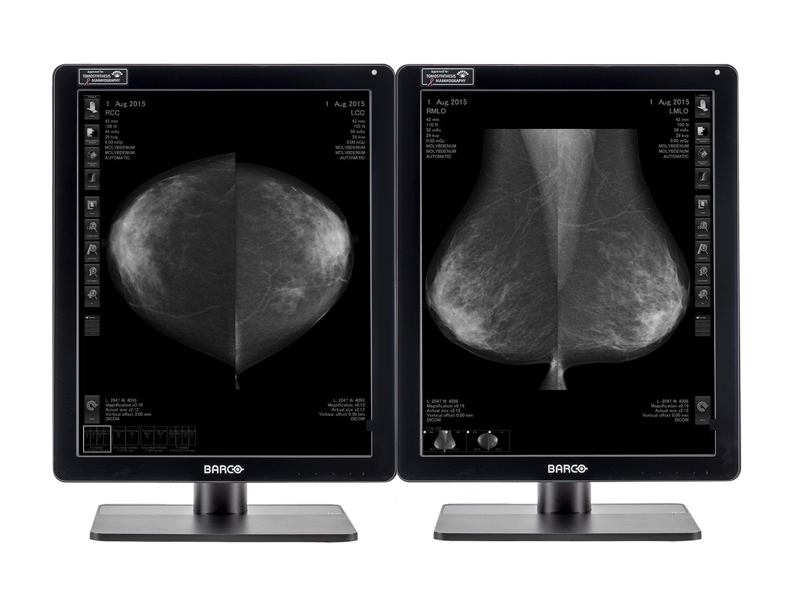 Barco Nio MDNG-6221 5MP 21" Grayscale LED Mammo 3D-DBT Breast Imaging Display (K9300372B)