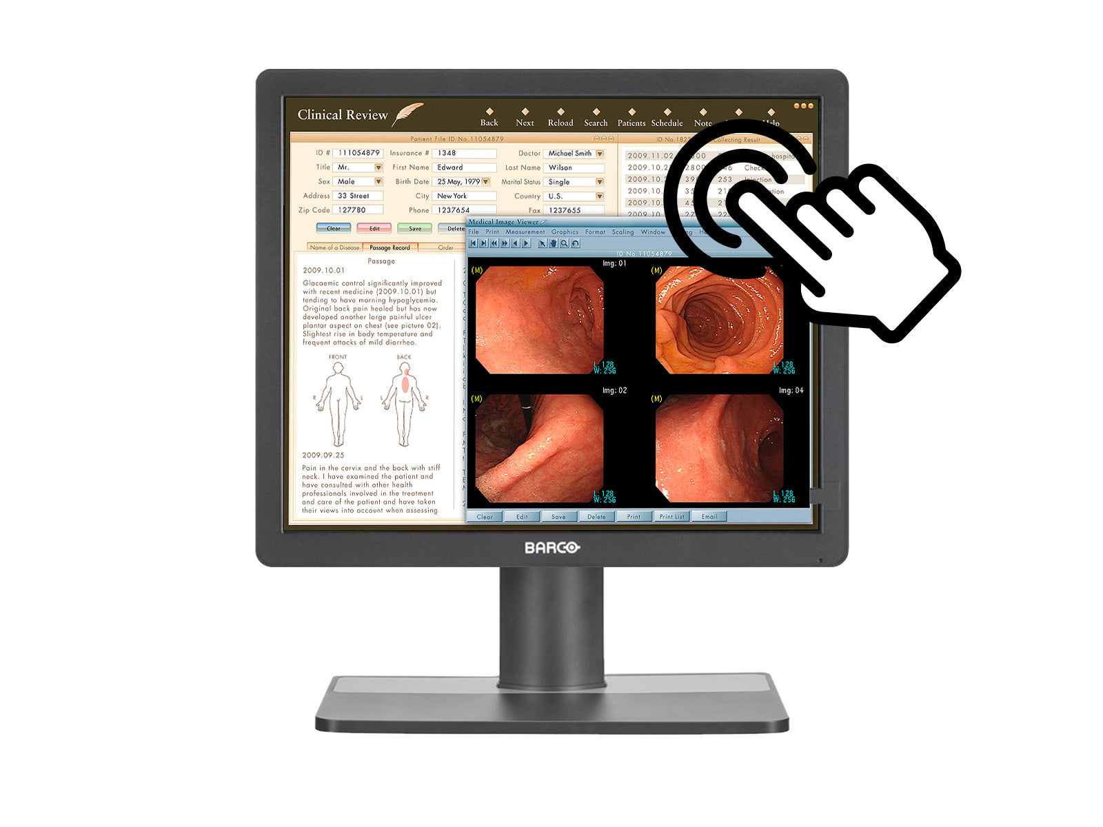 Barco MDRC-1219 TS Pantalla de revisión clínica con pantalla táctil a color de 1 MP y 19" (K9301821A) Monitors.com