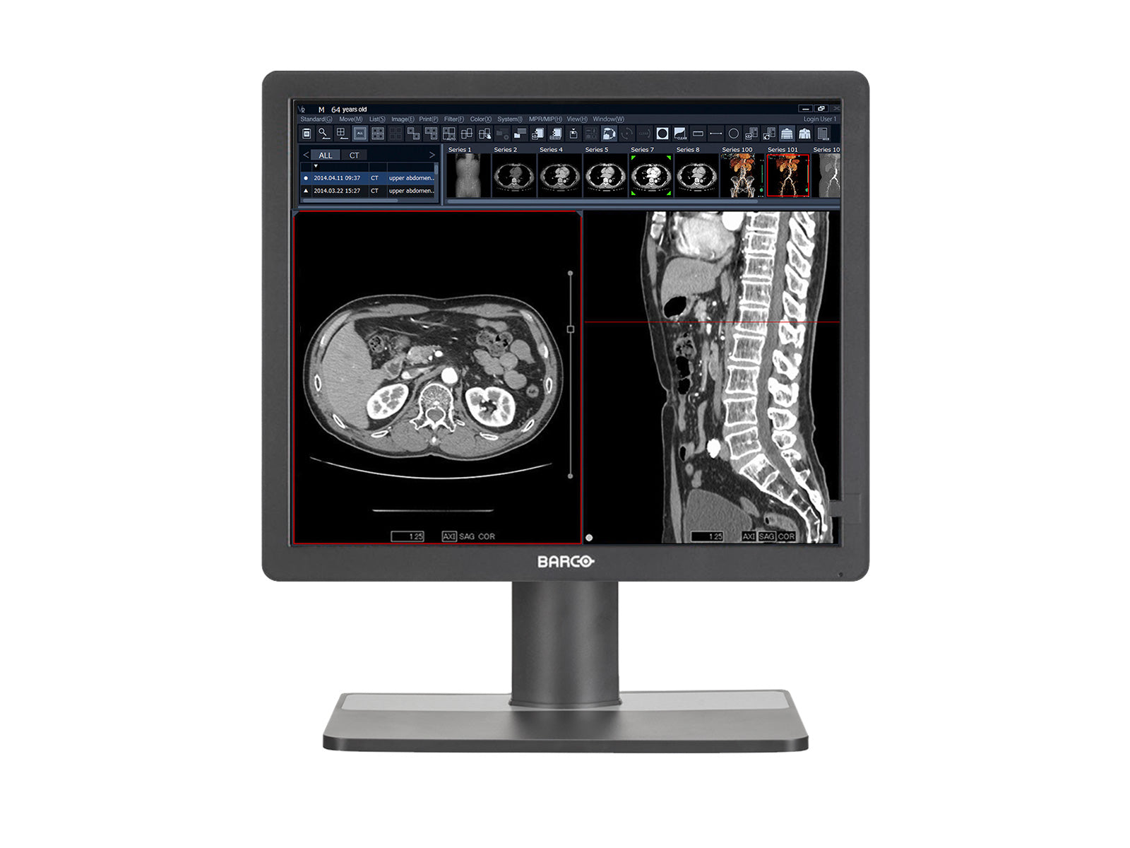 Barco MDRC-1219 1MP 19" Color Clinical Review Display (K9301820A) Monitors.com 