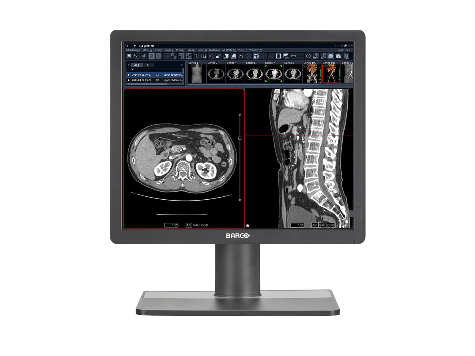 Barco MDRC-1219 1MP 19"-Farbdisplay für klinische Untersuchungen (K9301820A) Monitors.com