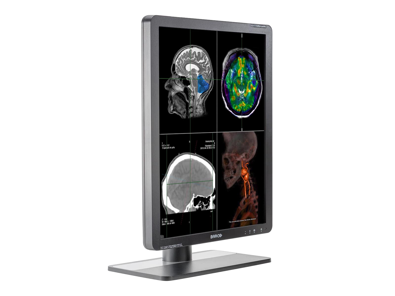 Barco® Eonis MDRC-2221 2MP Color LED Radiology Display Barco® Eonis MDRC-2221 2MP Color LED Radiology Display