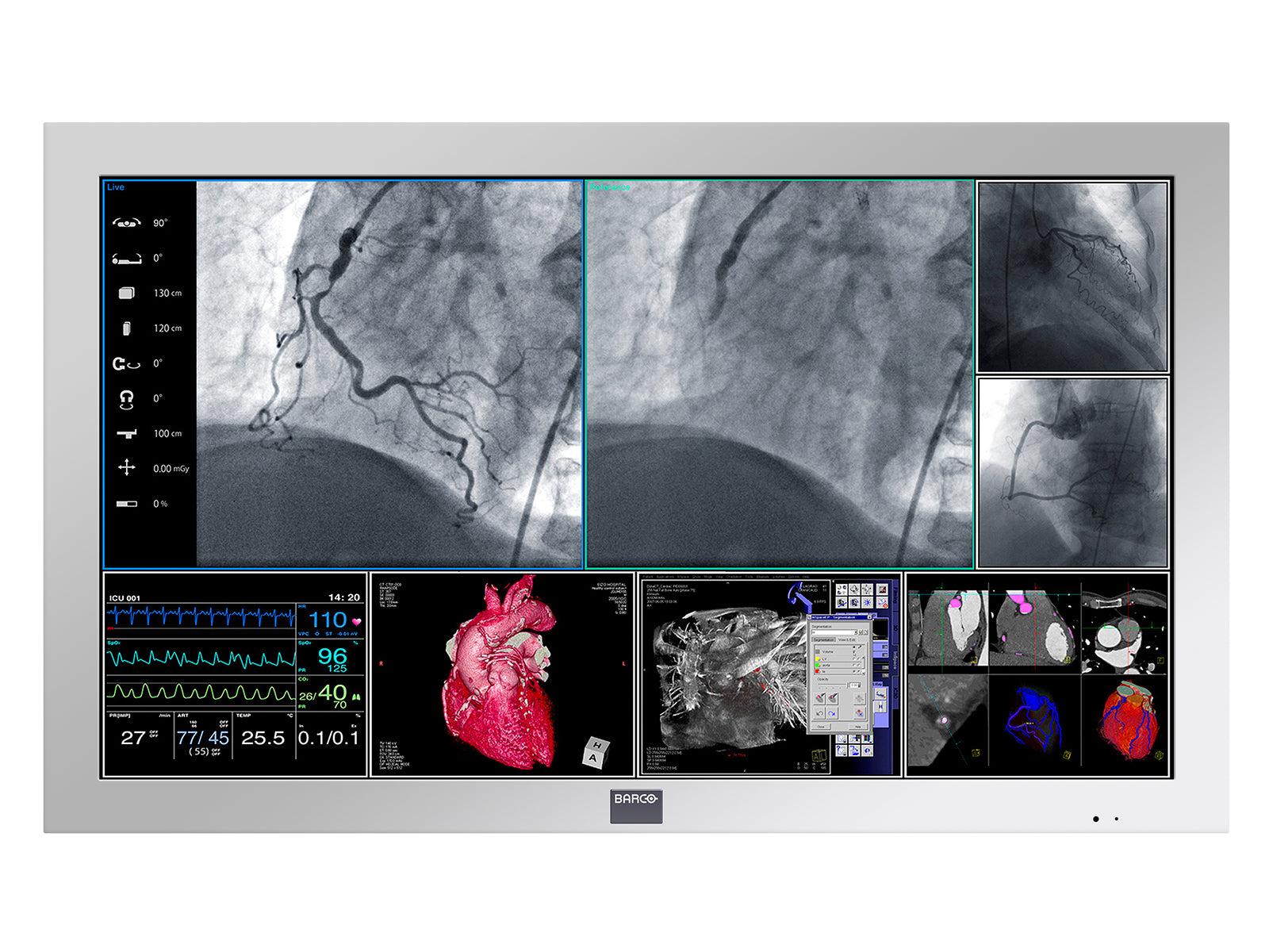 Barco MDSC-2242 Monitor de pantalla médico quirúrgico en color Full HD de 42" y 2 MP (K9307914) Monitors.com