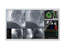 Barco MDSC-8255 LED 55" 8MP 4K Monitor medico chirurgico a colori (K9352360)