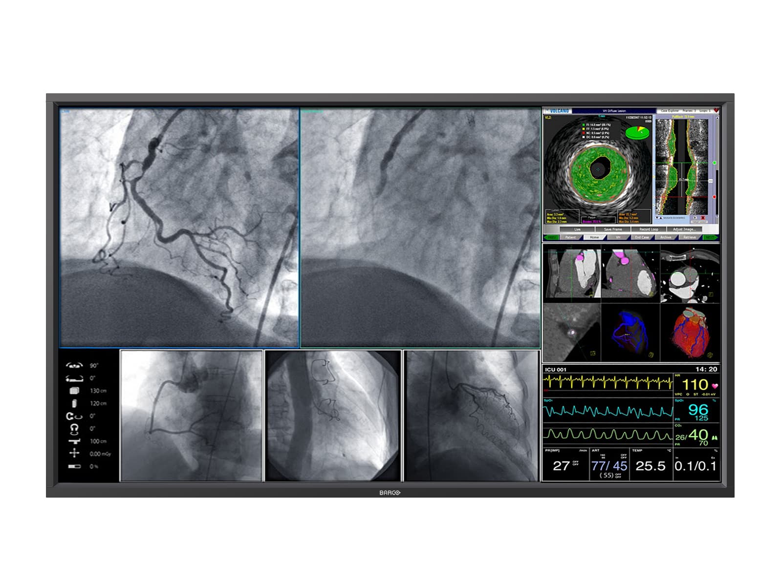 Barco Monitor de pantalla médica Steris MDSC-8258 RLG de 58" 8MP 4K (K9307852 / RBDV58MG8MP) Monitors.com