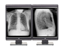JVC Totoku MS-S200 2MP 21" Monitor de radiología diagnóstica en escala de grises (MS-S200)