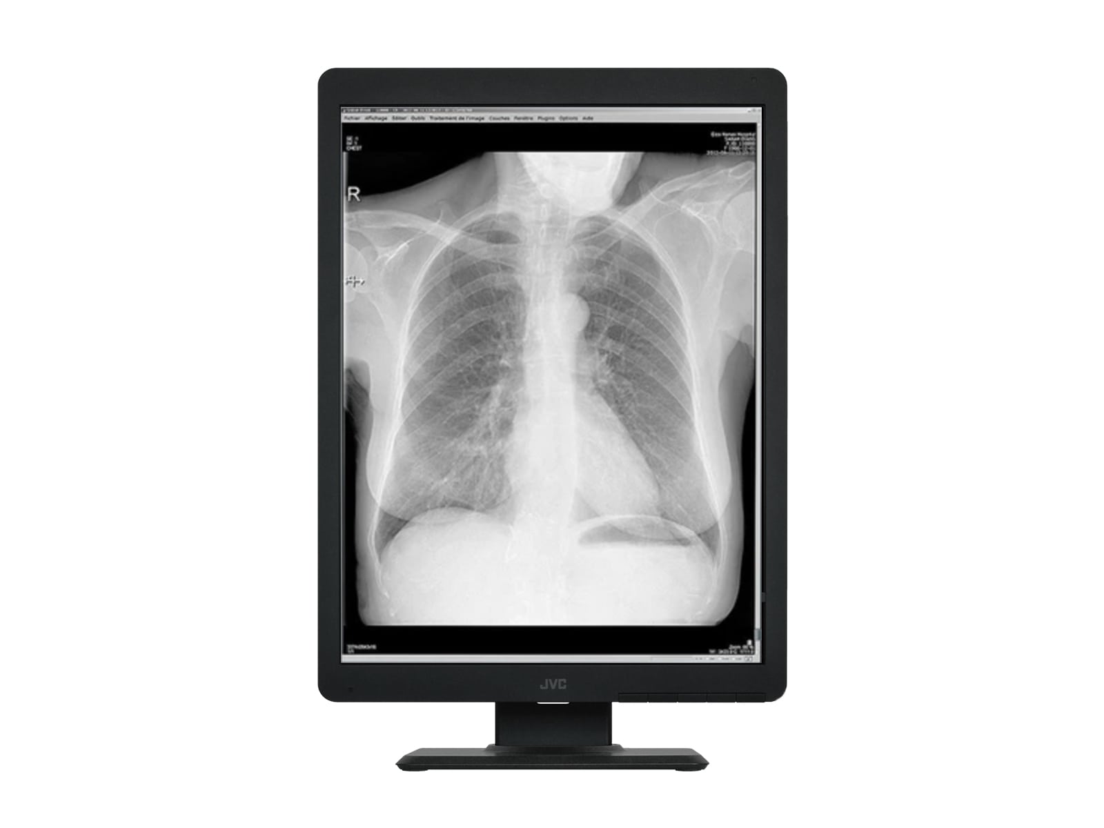 Vidar DiagnosticPro Edge Allgemeiner Radiologie- und Mammographie-Filmdigitalisierer (19580-001) Monitors.com