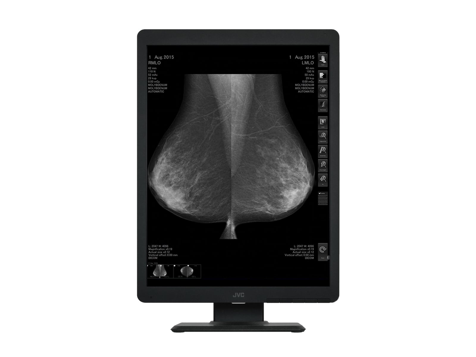 محول رقمي لفيلم التصوير الشعاعي للثدي Vidar CAD Pro Advantage (15790-002)