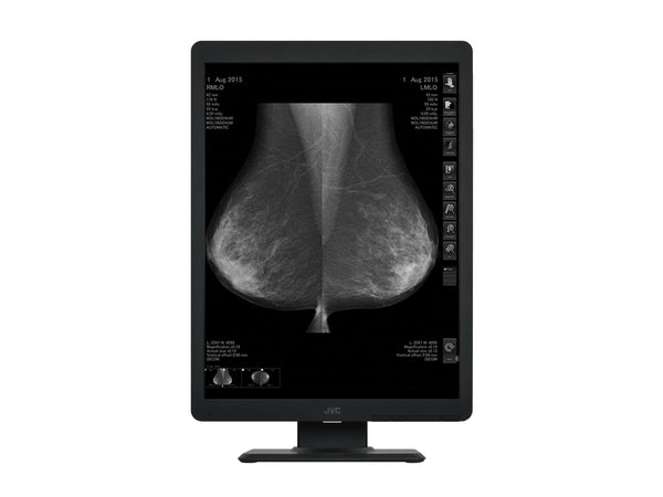 Vidar CAD Pro Advantage Mammography Film Digitizer (15790-002)