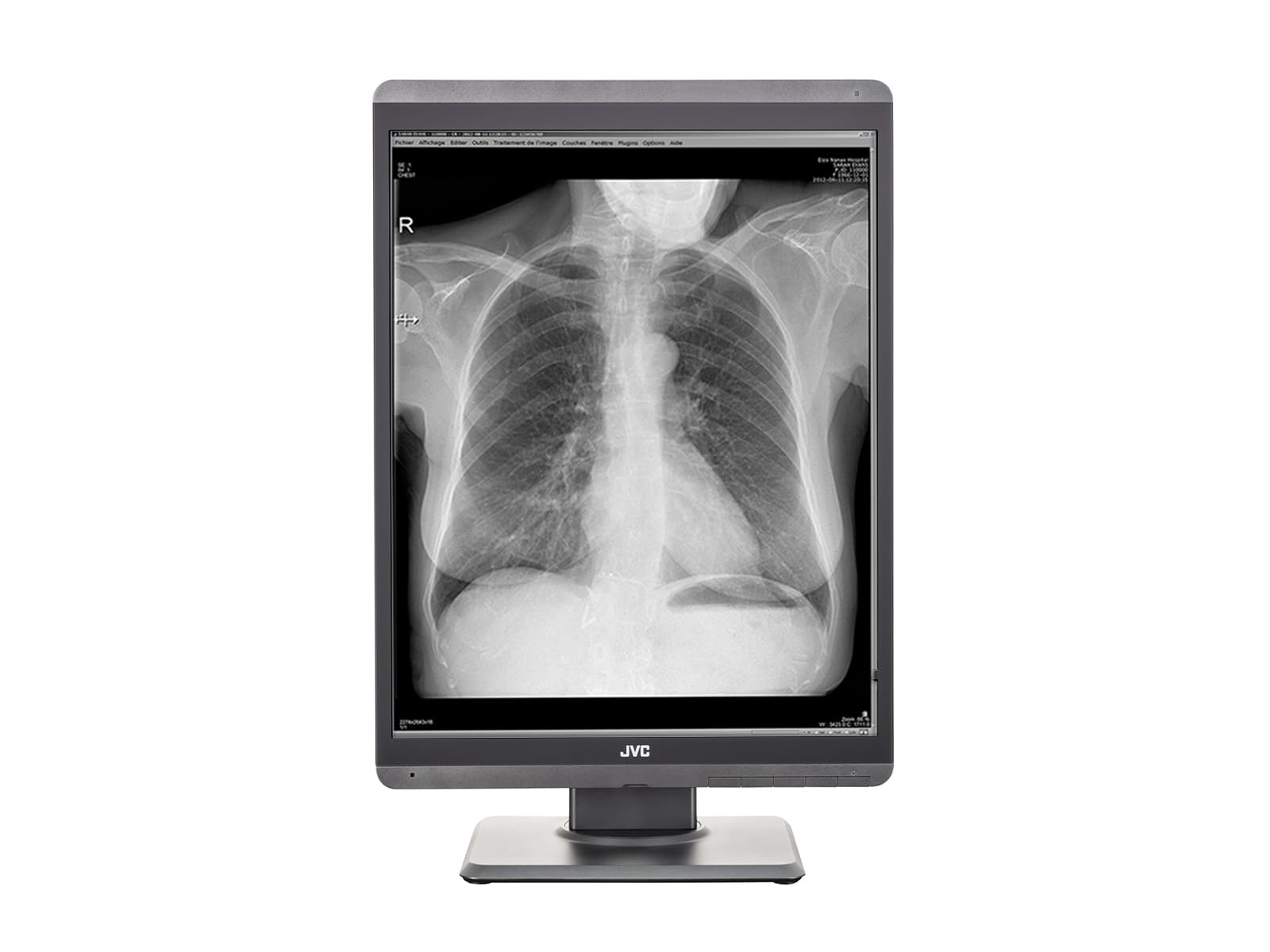 JVC Totoku MS-S300 3MP 21" LED Grayscale General Radiology Diagnostic Display Monitor (MS-S300) Monitors.com 
