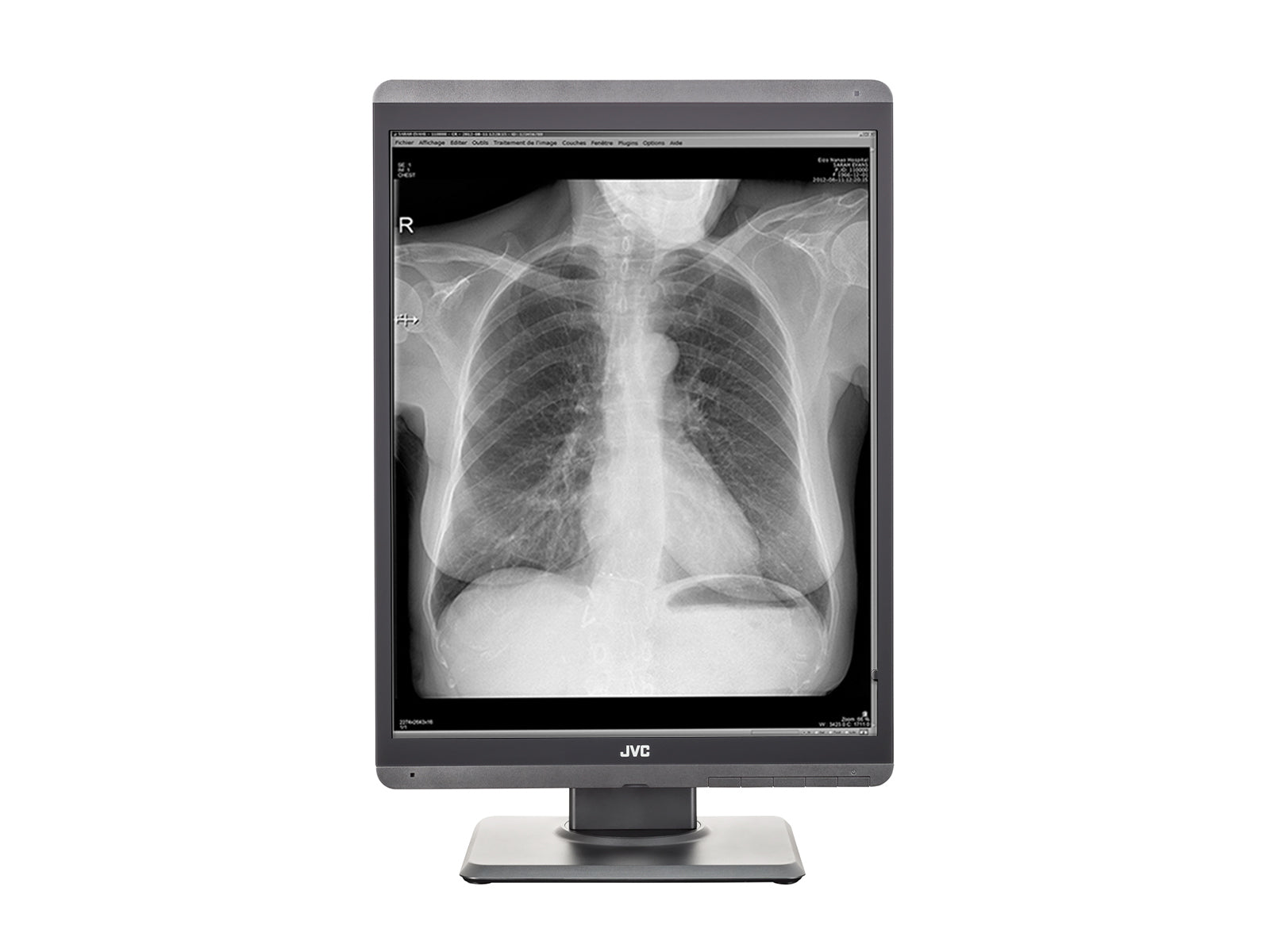 JVC Totoku MS-S200 2MP 21" Grayscale Diagnostic Radiology Display Monitor (MS-S200)