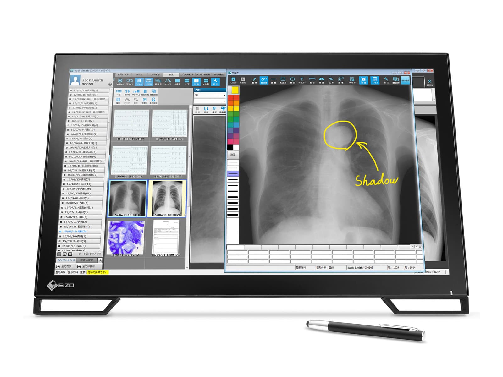 Eizo Radiforce MS236WT Monitor dental LCD multitáctil de revisión clínica con lápiz óptico (MS236WT)