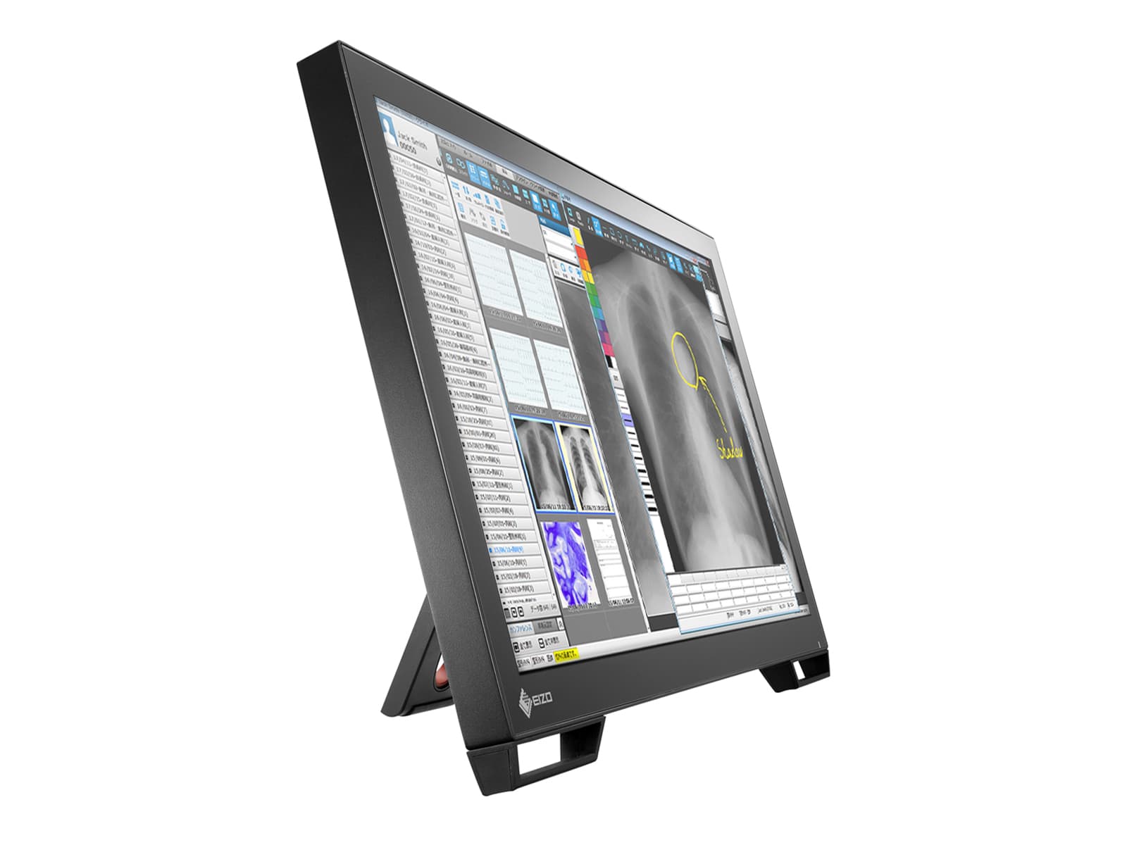 Eizo Radiforce MS236WT 2MP 23" Multi-Touch Color Clinical Review LED Dental Monitor with Stylus Pen (MS236WT)