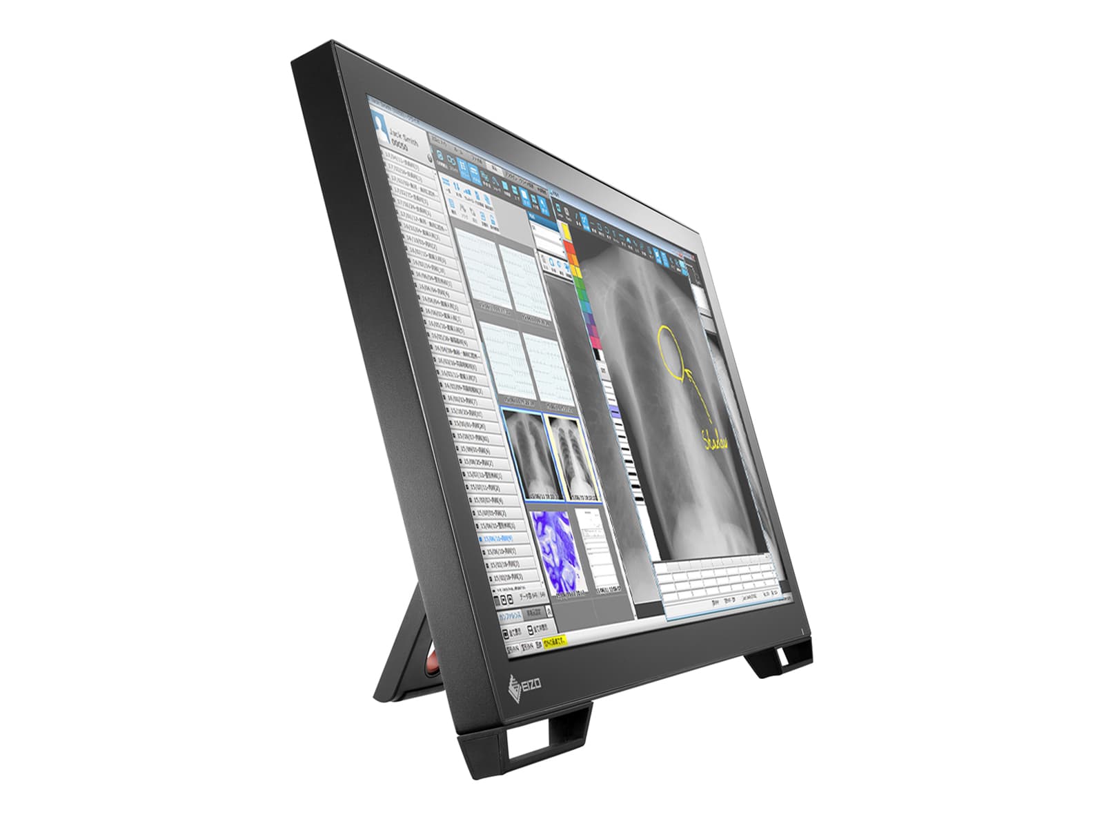 Eizo Radiforce MS236WT Multi-Touch Clinical Review LCD Dental Monitor with Stylus Pen (MS236WT) 