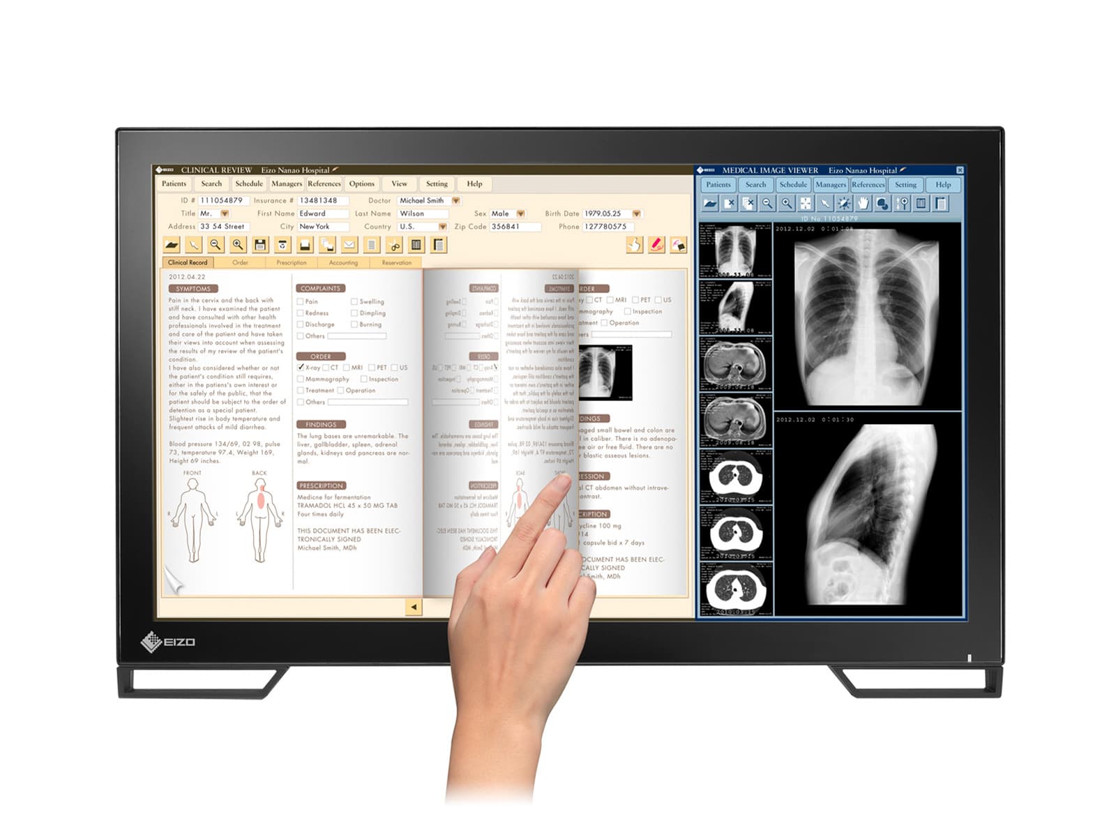 Eizo Radiforce MS236WT 2MP 23" Multi-Touch Color Clinical Review LED Dental Monitor with Stylus Pen (MS236WT) Monitors.com 