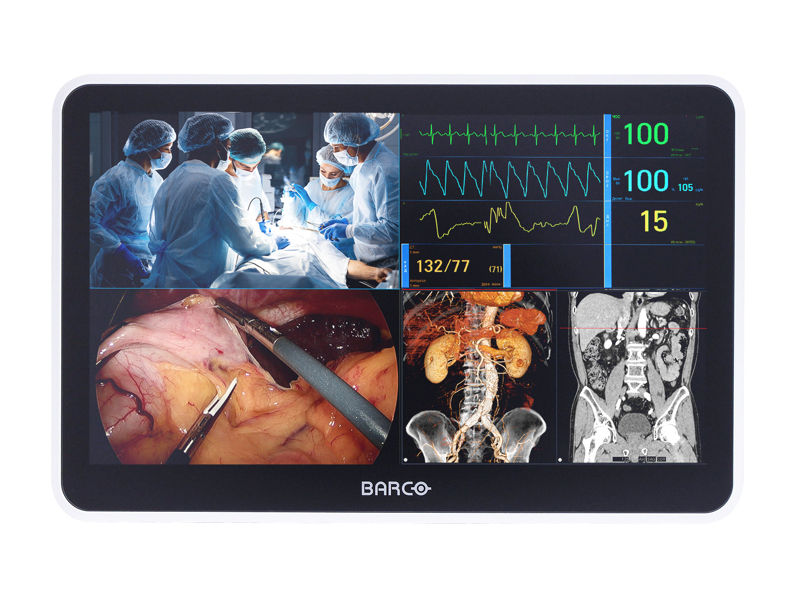Barco MUIP-2112 Monitor con schermo multi-touch a colori da 12,5" per revisione clinica