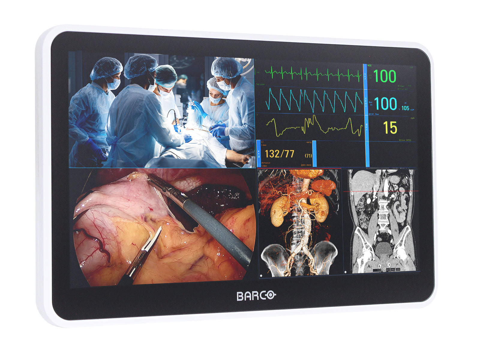 Barco MUIP-2112 Monitor con schermo multi-touch a colori da 12,5" per revisione clinica
