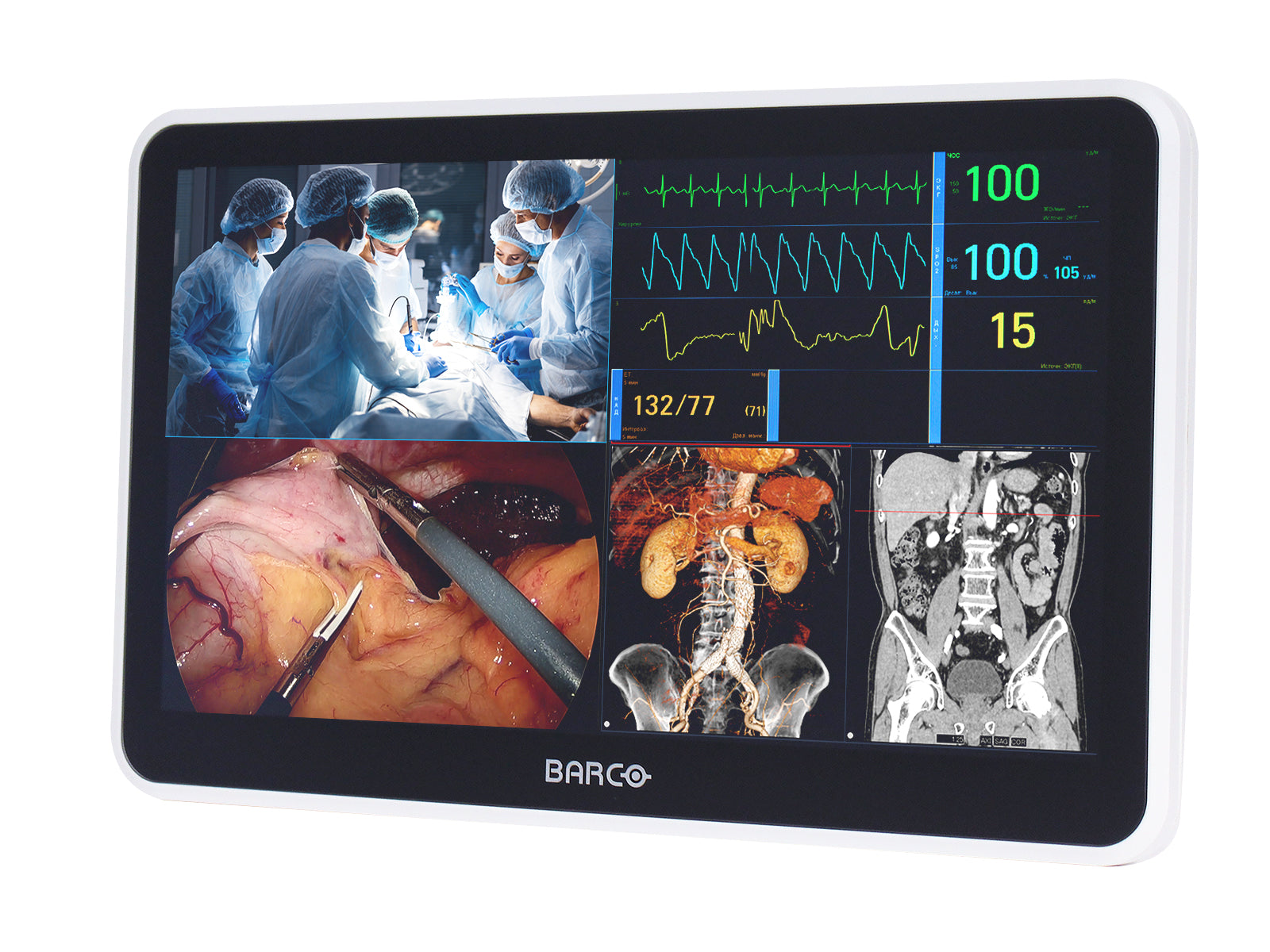 Barco MUIP-2112 Monitor con schermo multi-touch a colori da 12,5" per revisione clinica