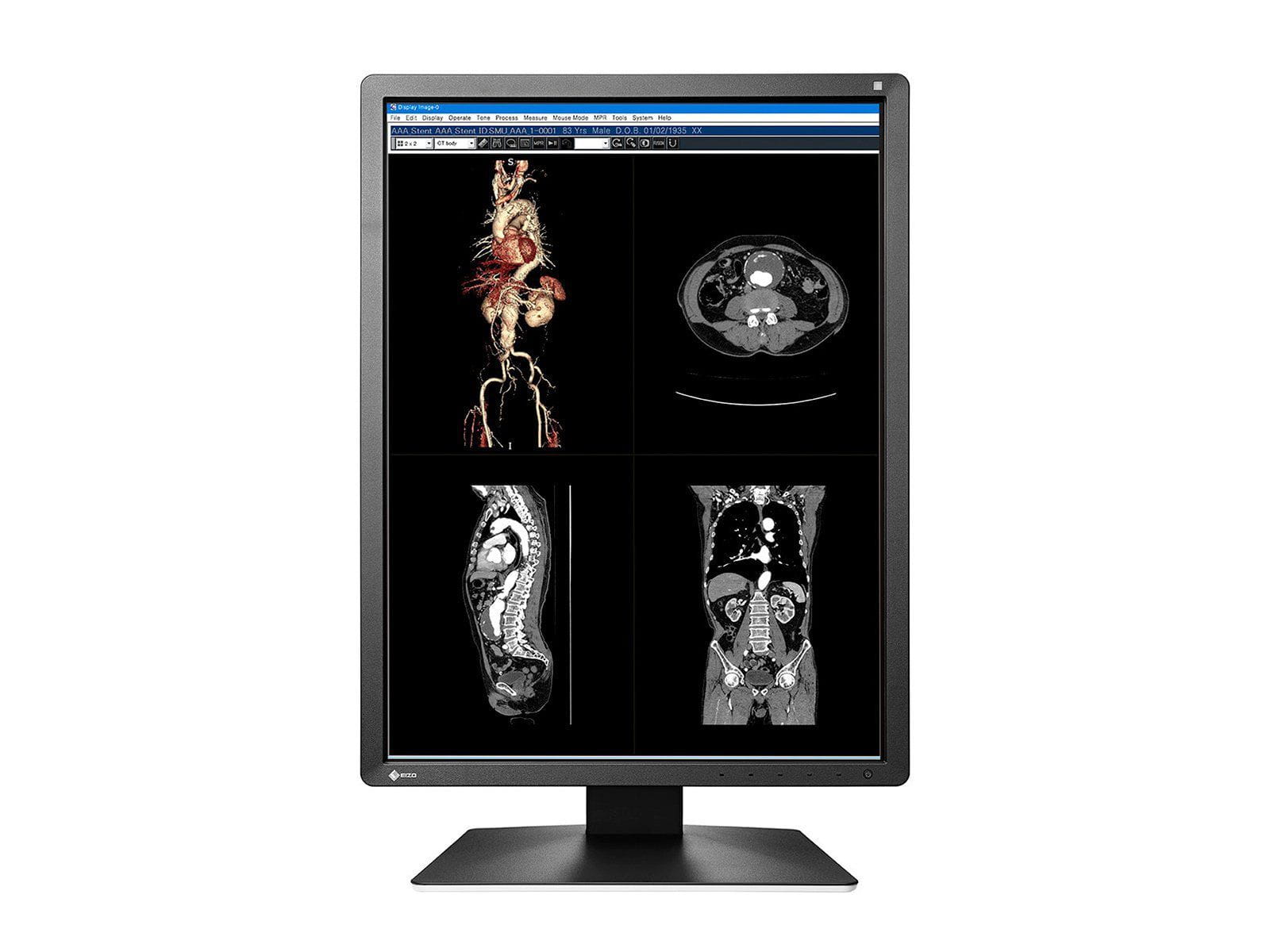 Eizo RadiForce MX216 2MP 21" Color LED Medical Display Monitor (MX216-BK) Monitors.com 