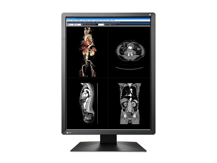 Eizo RadiForce MX216 2MP Color LED Medical Display Monitor