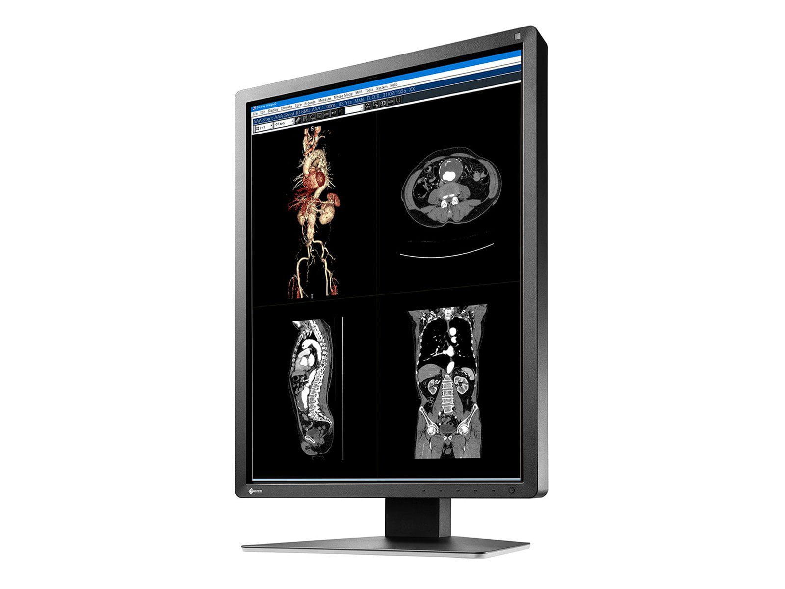 Eizo RadiForce MX216 2MP 21" medizinischer Farb-LED-Monitor (MX216-BK) Monitors.com