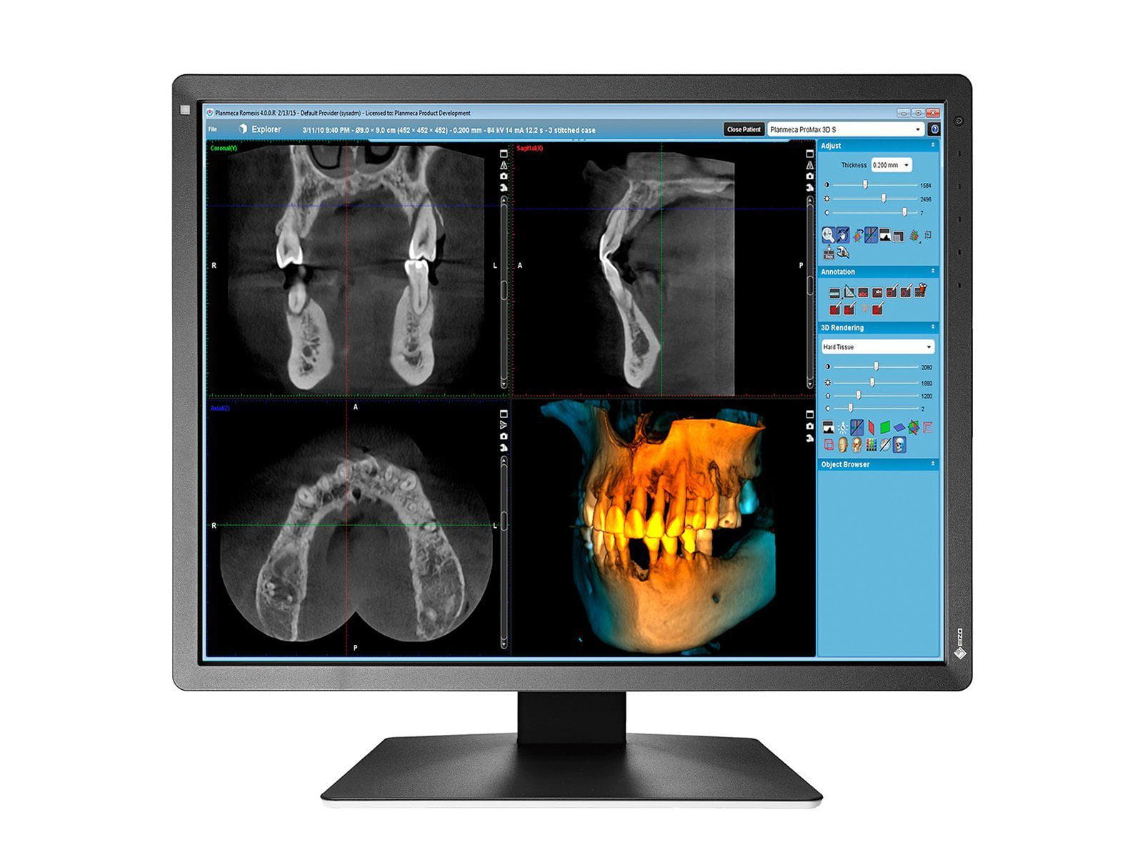 Eizo RadiForce MX216 Monitor de pantalla médica LED en color de 2MP y 21" (MX216-BK) Monitors.com