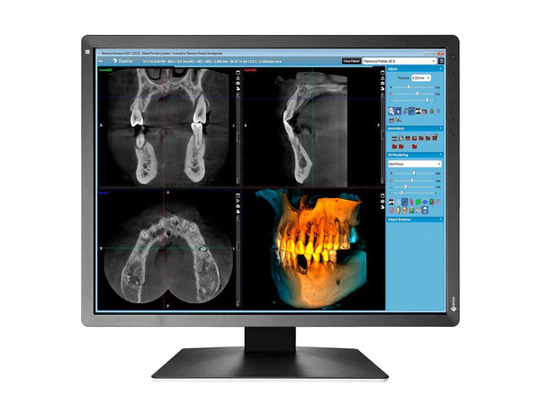 Eizo RadiForce MX216 2MP 21