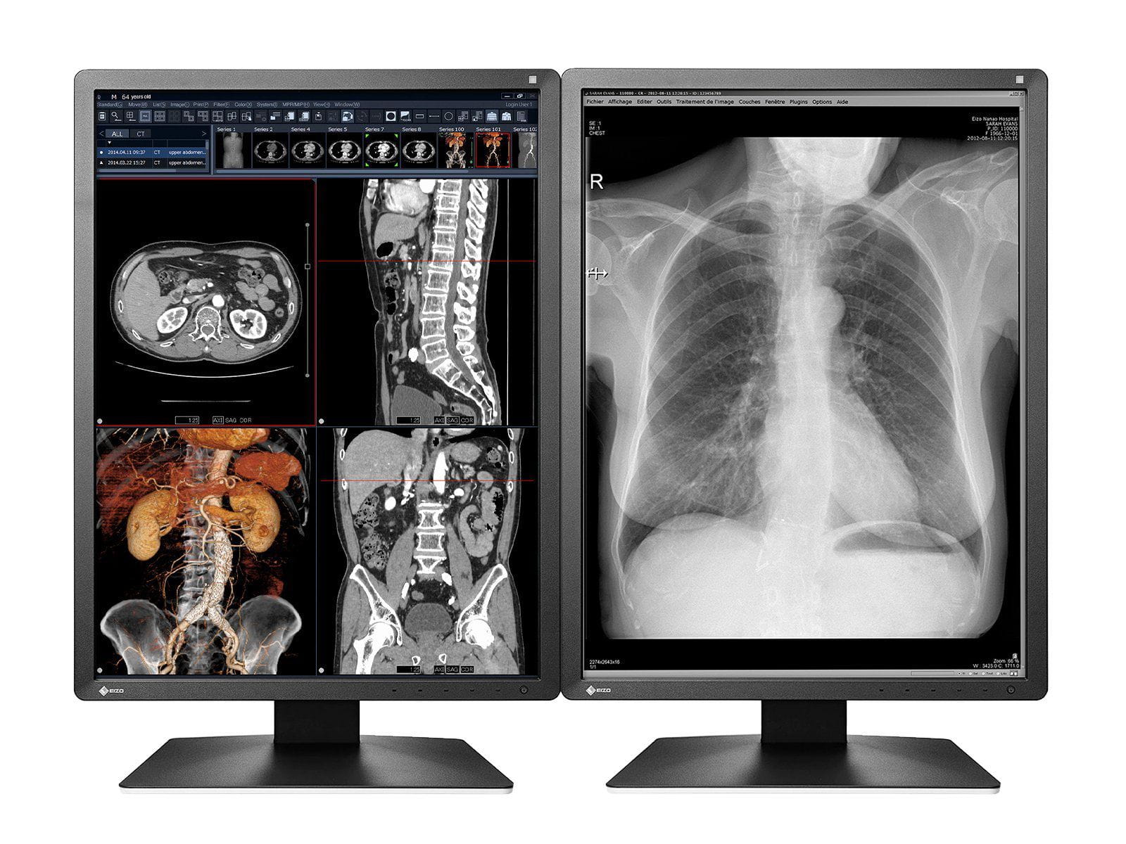 Moniteur médical à affichage LED couleur Eizo RadiForce MX216 2MP 21" (MX216-BK) Monitors.com