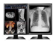 Eizo RadiForce MX216 Monitor medico a colori LED da 21 MP da 2 MP (MX216-BK)