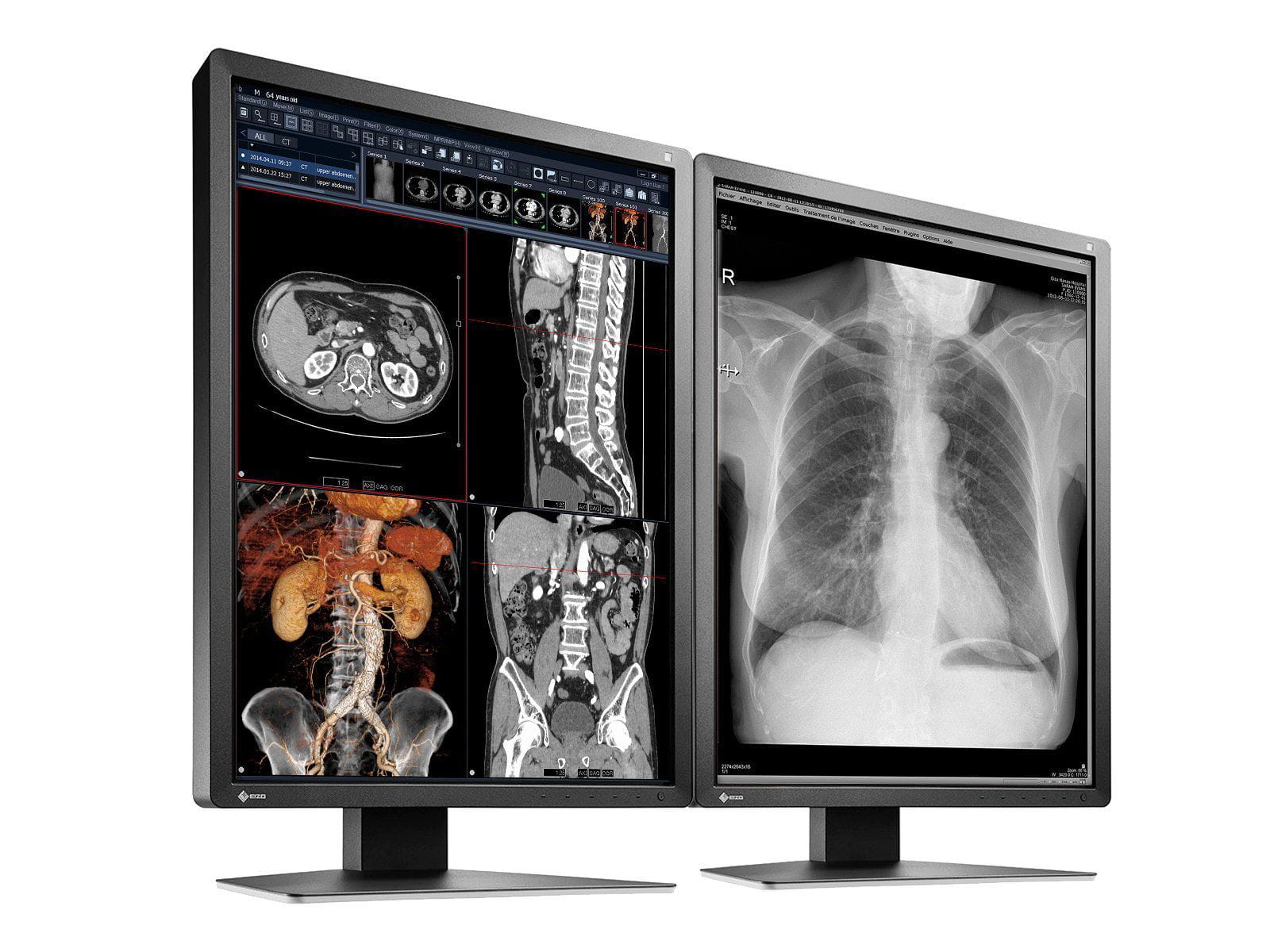 Eizo RadiForce MX216 Monitor de pantalla médica LED en color de 2MP y 21" (MX216-BK) Monitors.com