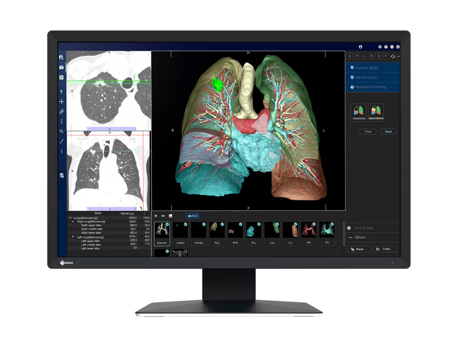 Pantalla de revisión clínica LED en color Eizo RadiForce MX243W de 2.3 MP y 24" (MX243W)