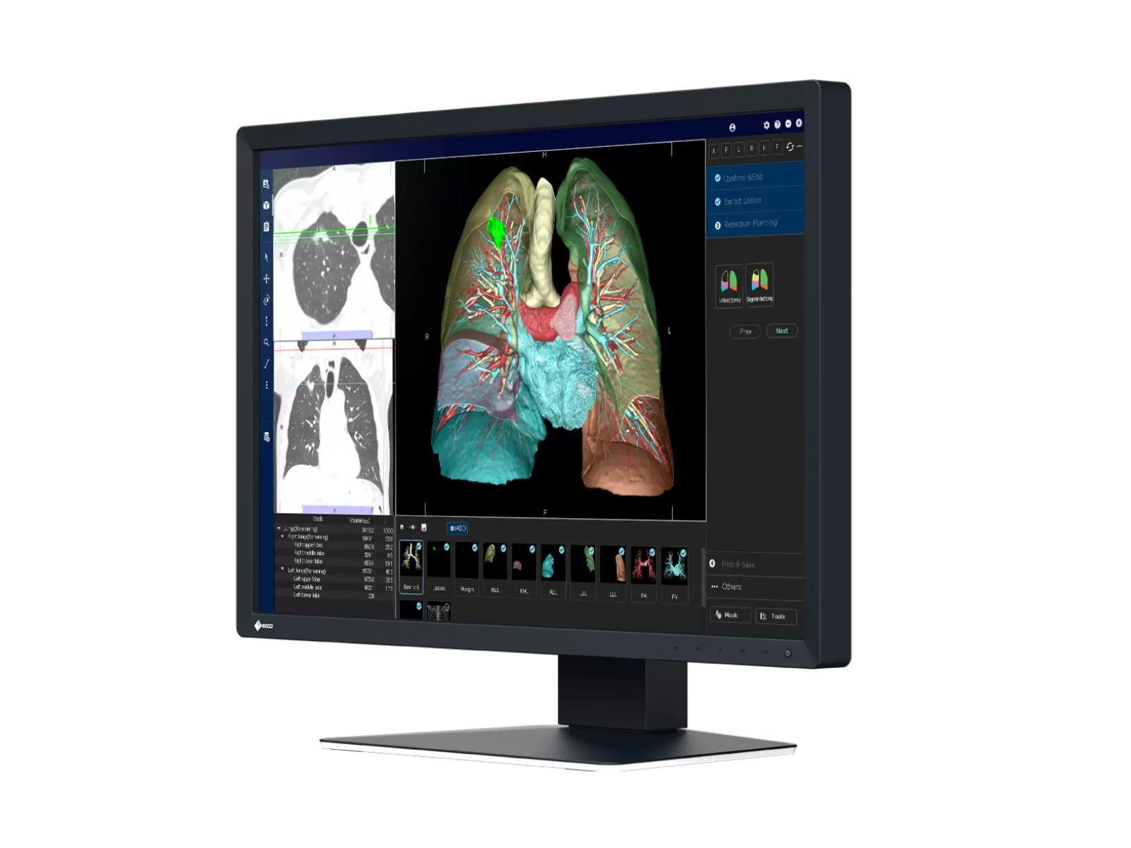 Eizo RadiForce MX243W 2.3MP 24" Color LED Clinical Review Display (MX243W) Monitors.com 