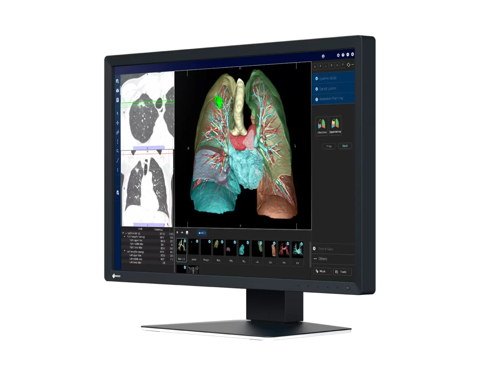 Eizo RadiForce MX243W 2.3 MP 24-Zoll-Farb-LED-Display für klinische Untersuchungen (MX243W)