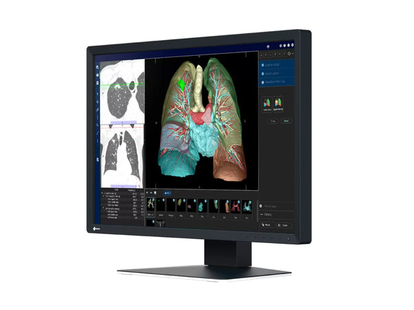 Eizo RadiForce MX243W 2.3MP 24