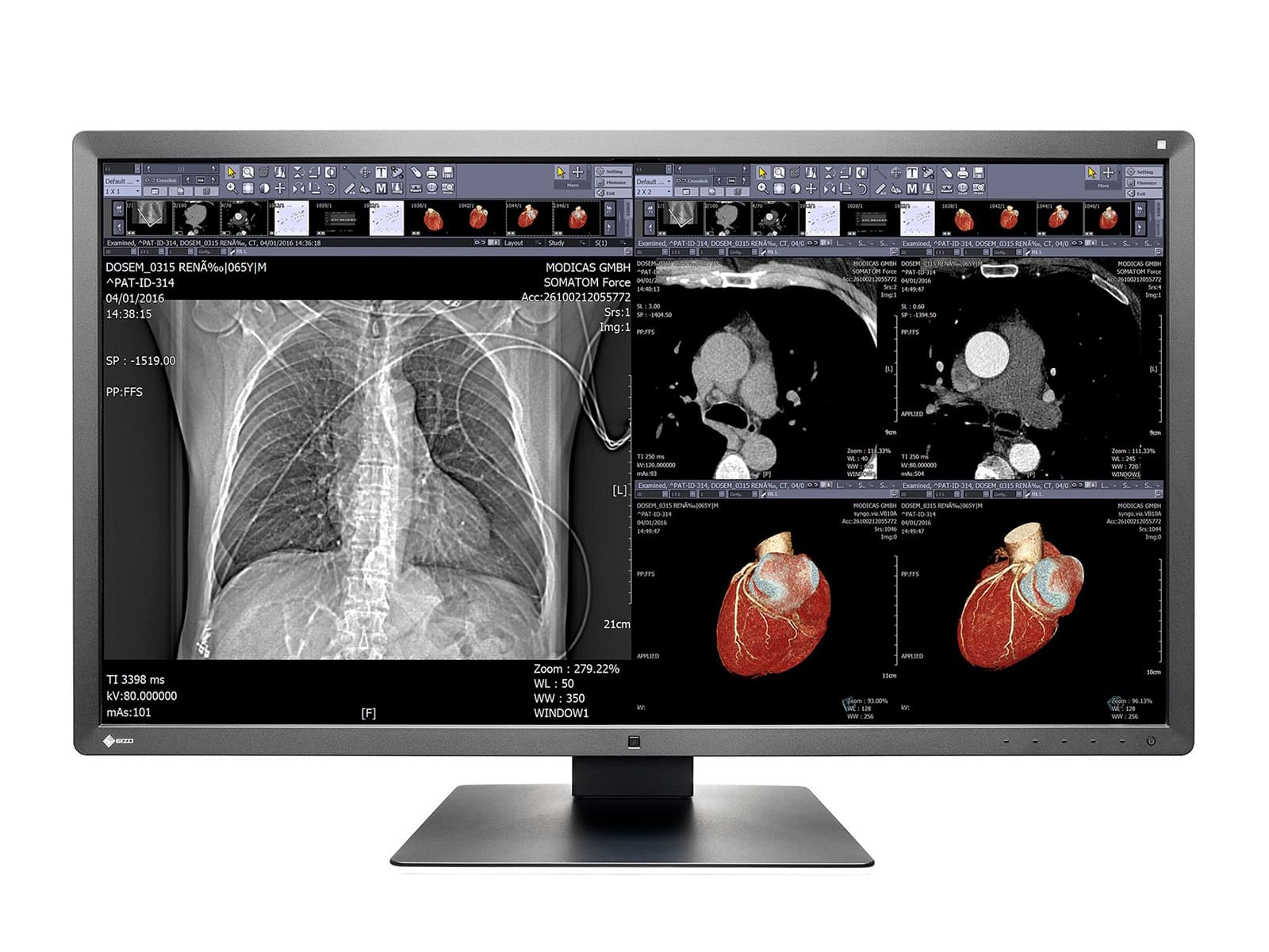 Monitor de pantalla de revisión clínica en color Eizo RadiForce MX315W de 8MP y 31" (MX315W-BK) Monitors.com