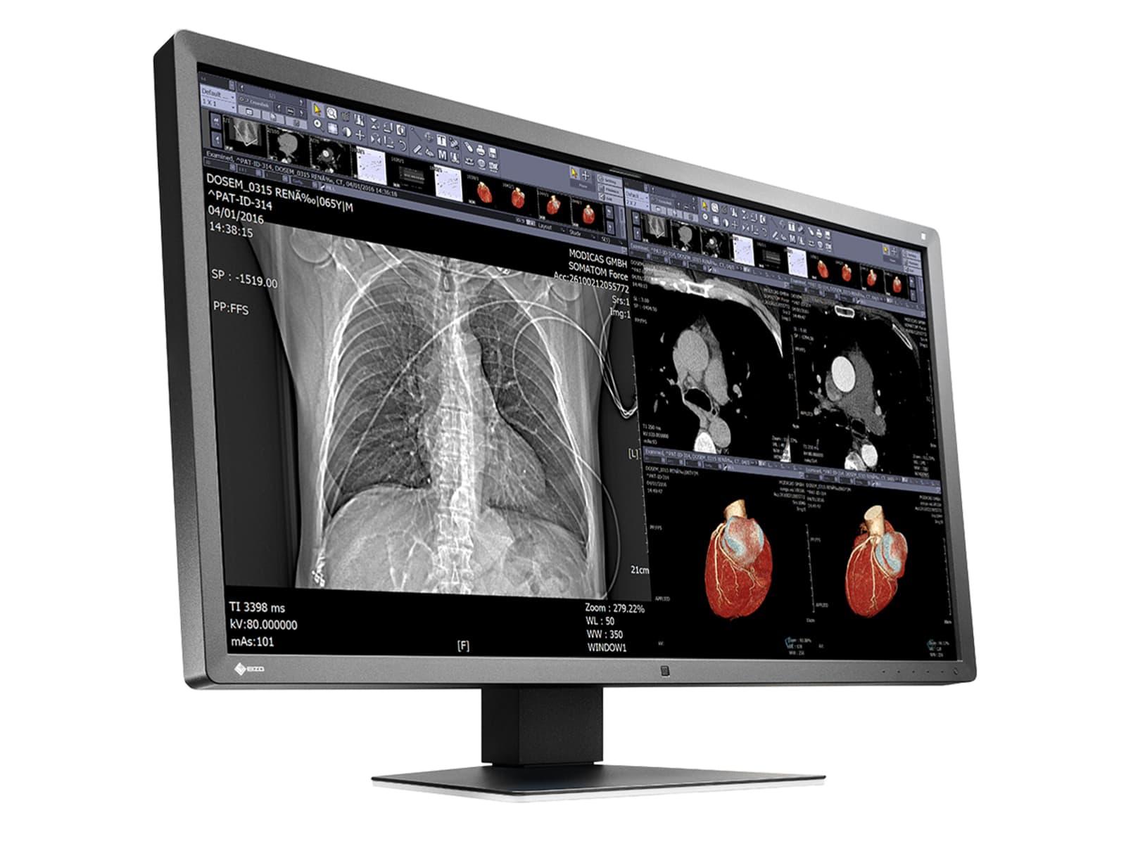 Eizo RadiForce MX315W 8MP 31" Farbmonitor mit klinischem Testbericht (MX315W-BK) Monitors.com