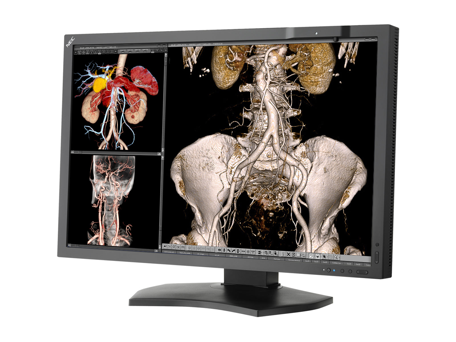 NEC MultiSync MD302C4 4MP 30" Color LED General Radiology PACS Display (MD302C4) Monitors.com 