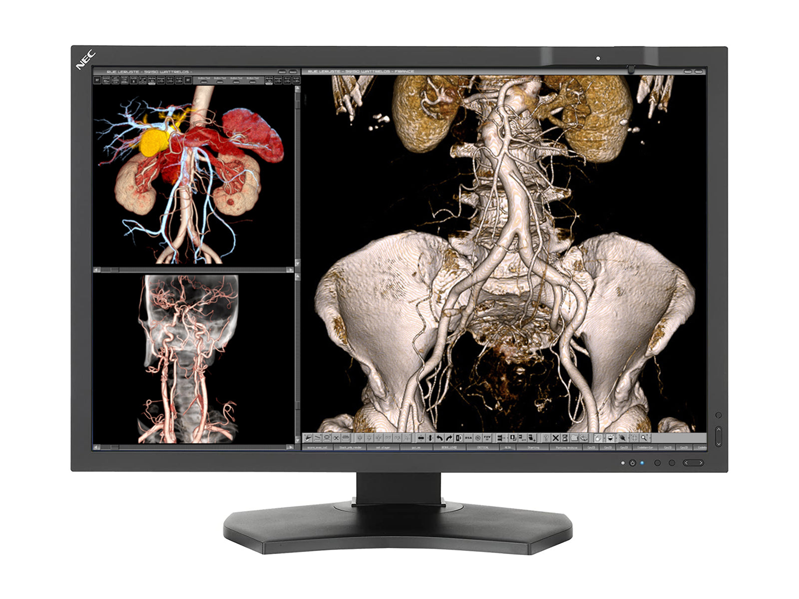 NEC MultiSync MD302C4 4MP 30" Color LED General Radiology PACS Display (MD302C4) Monitors.com 