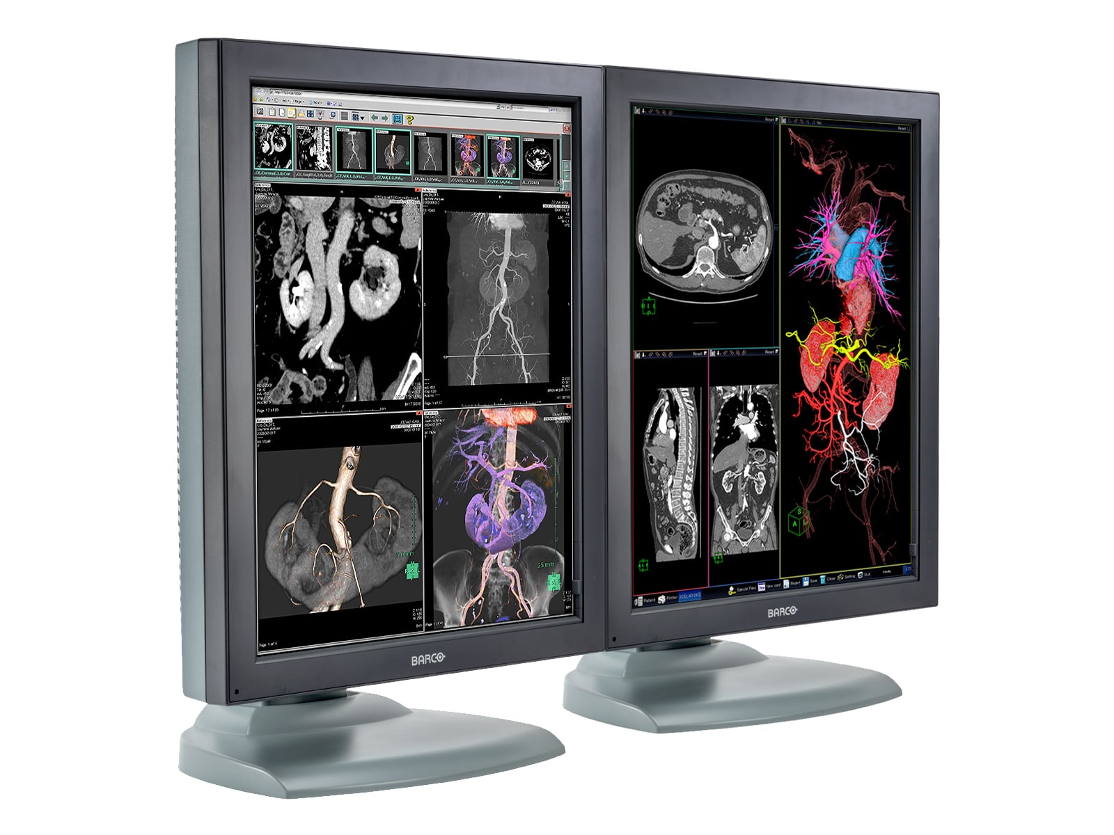 Barco Nio MDNC-3121 HighBright 3MP 21" Color Medical Diagnostic Radiology Monitor