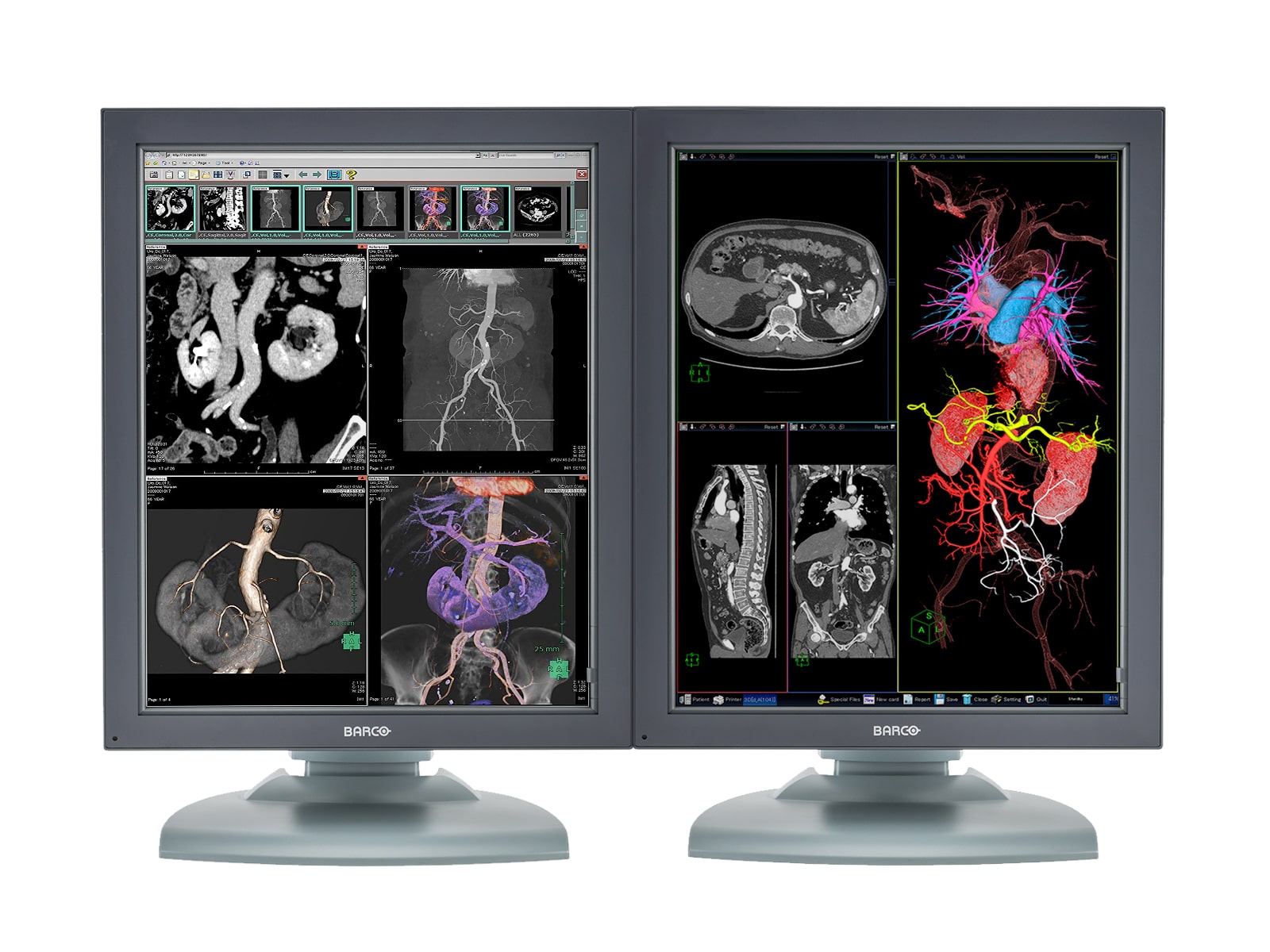 Barco Nio MDNC-3121 Monitor de radiología de diagnóstico médico en color de 3MP y 21" (K9603023) Monitors.com